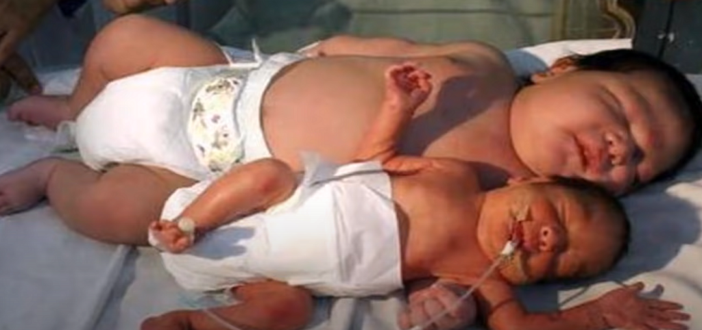 Bebé gigante comparación con otro recién nacido
