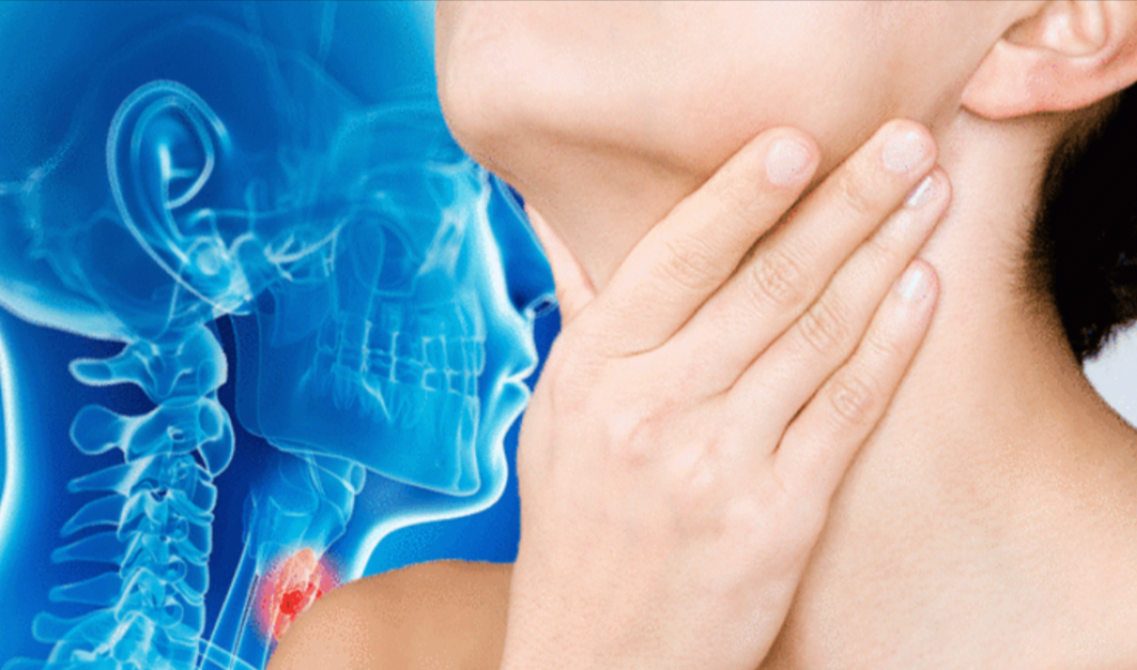 Cáncer de garganta
Comúnmente el cáncer de garganta aparece en personas que sobrepasan los 50 años de edad